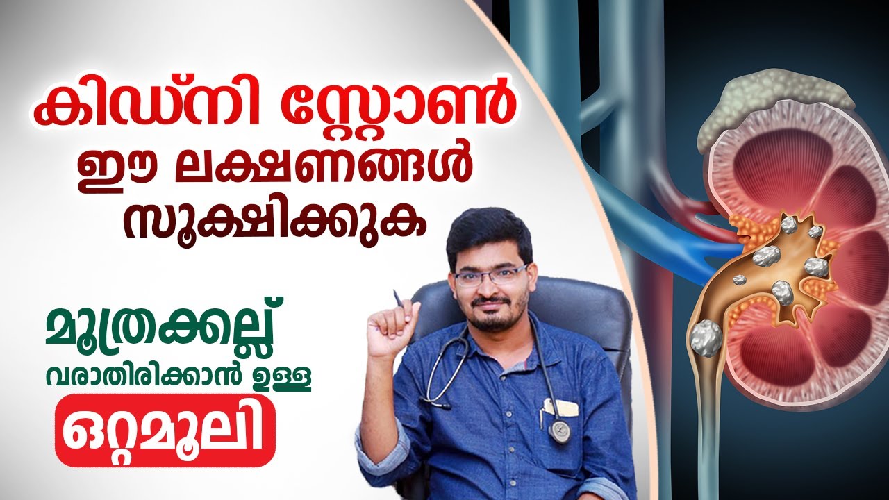 കിഡ്‌നി സ്റ്റോൺ ഈ ലക്ഷണങ്ങൾ സൂക്ഷിക്കുക | Kidney Stone Home Remedy | Dr Basil Yousuf