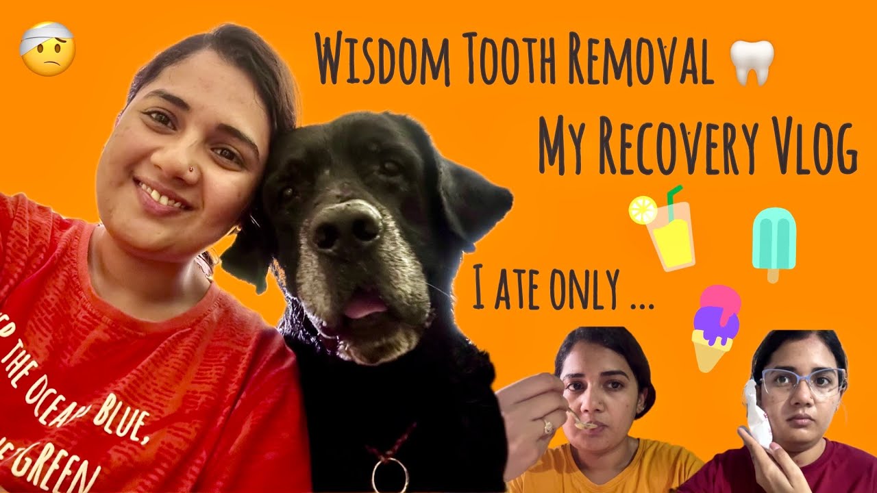 Wisdom Tooth Surgery and Recovery 10 Days Vlog 🦷 + What I Ate 🍦