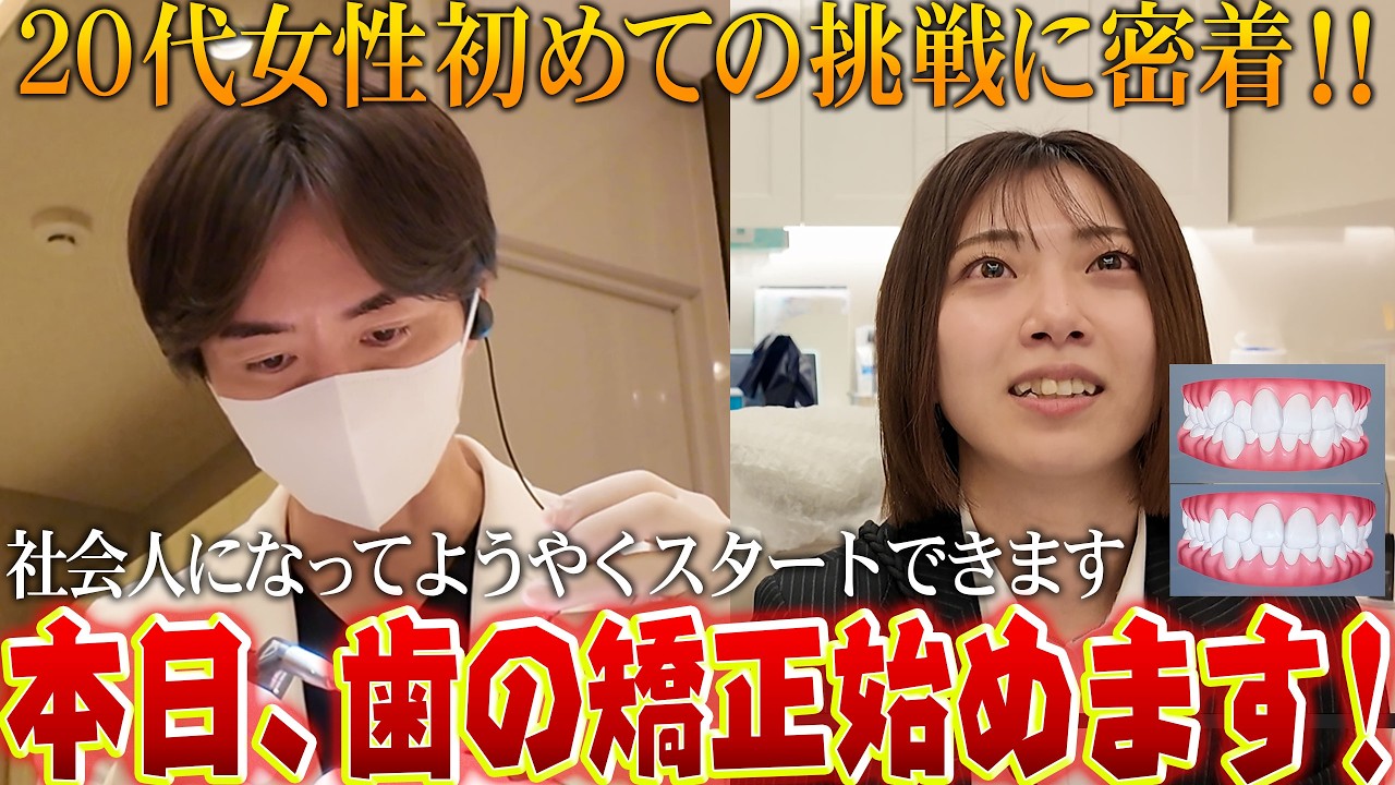 高校の時から歯並びで悩んでいました…思い切り笑って写真を撮りたい！20代女性をDr.野島がマウスピース矯正する！矯正ドキュメンタリー　