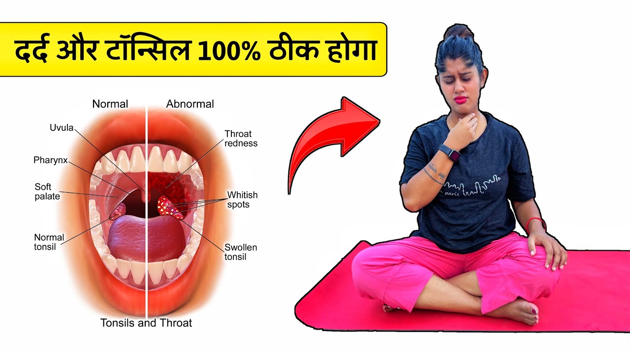 गले का दर्द और टॉन्सिल को खत्म करने के लिए योगासन | Yoga for Tonsil Problems | Yogawale