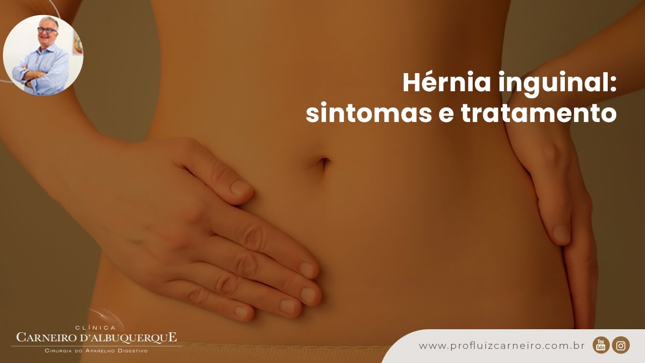 Hérnia inguinal: sintomas e tratamento | Prof. Dr. Luiz Carneiro CRM 22761