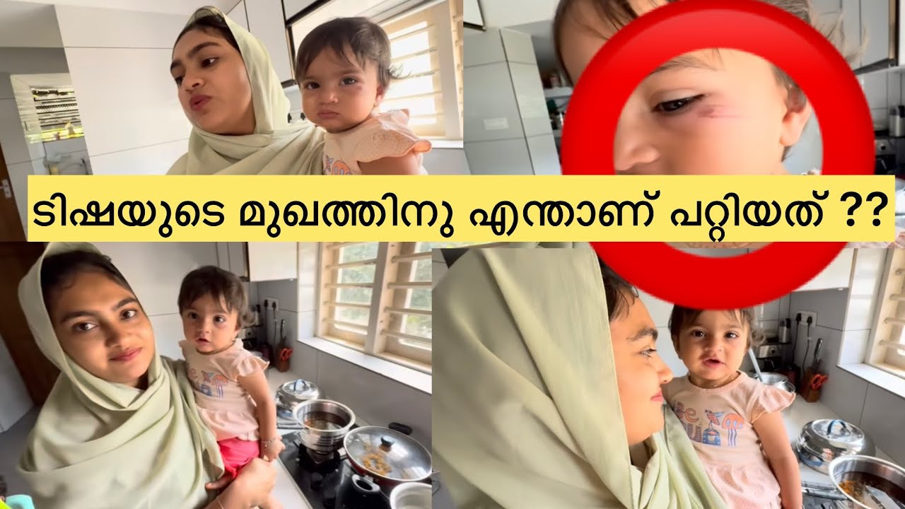 ടിഷയുടെ മുഖത്തിന് എന്താണ് പറ്റിയത് ?? 😭😭 #familylife  #parenting  #couplevlog 