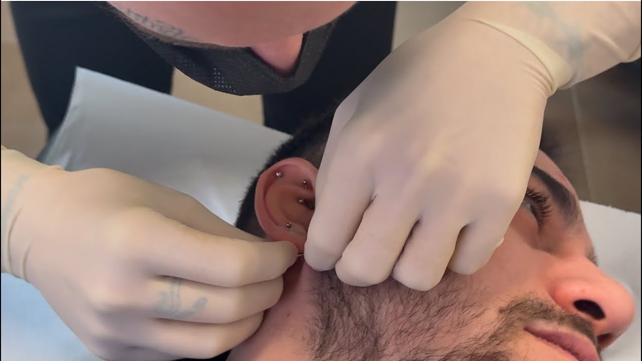 Eseguo il mio primo Piercing Guancialobo