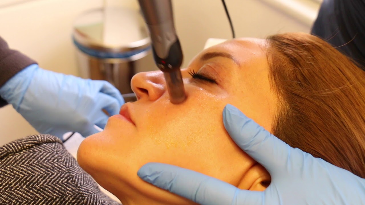 Retinol Serumu ve Dermapen