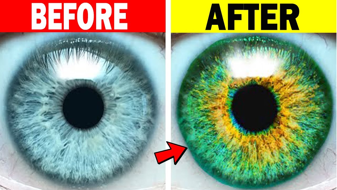 How To Lighten Your Eye Color Naturally With Honey? (The 30-Day Method)
