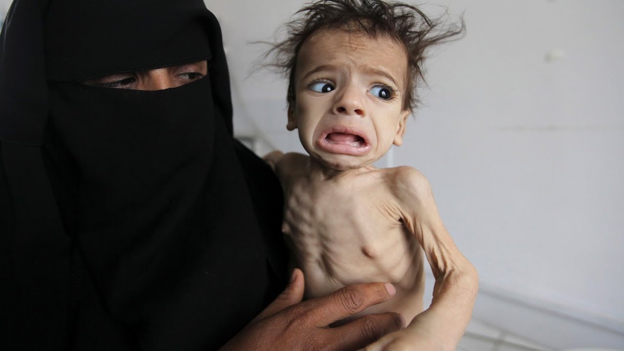 Yemeni Journalist: Saudi Arabia’s Total Blockade on Yemen is “Death Sentence” for All