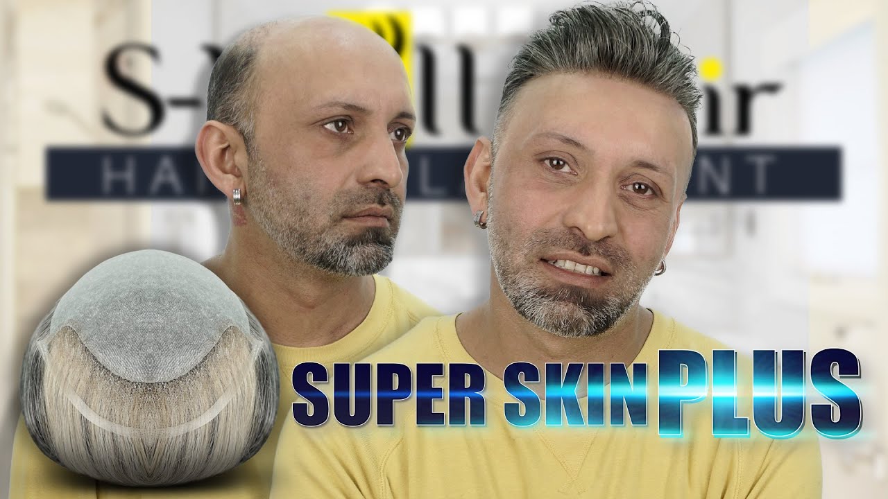 Super Skin Plus Protez Saç - Hair Replacement