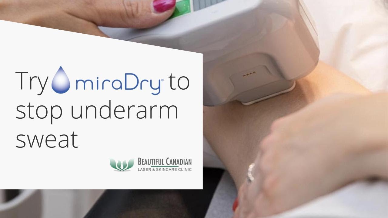 Vancouver miraDry® Provider: Explaining the Armpit Sweat Solution for Hyperhidrosis