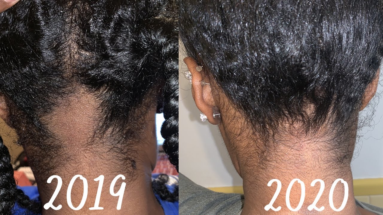 How My Hair Broke Off & How I Grew My Hair Back!!