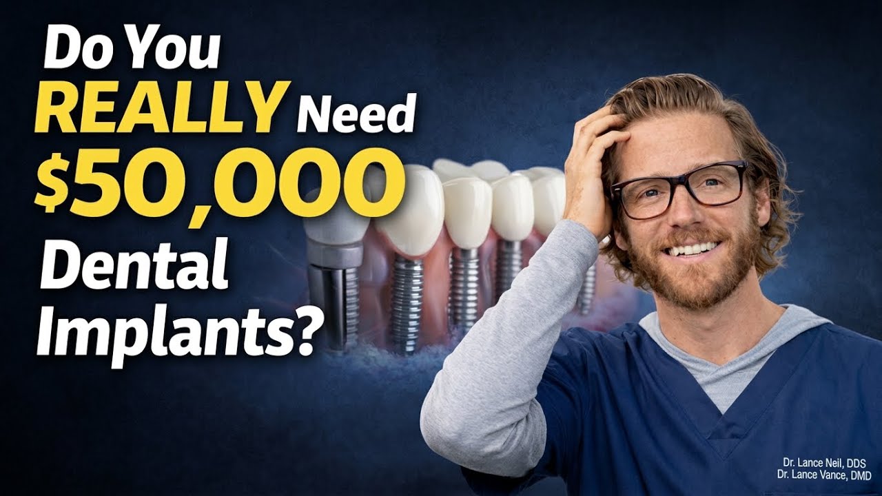 Do You Really Need $50,000 Dental Implants? (What Dentists Look For)