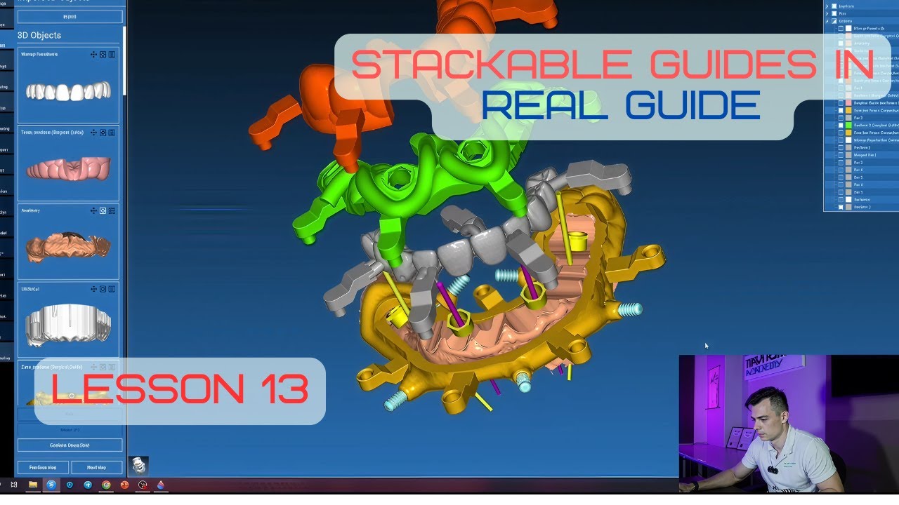 Surgical guides in RealGuide Tutorial. Lesson 13. Stackable guides,  All on 4. Part 3