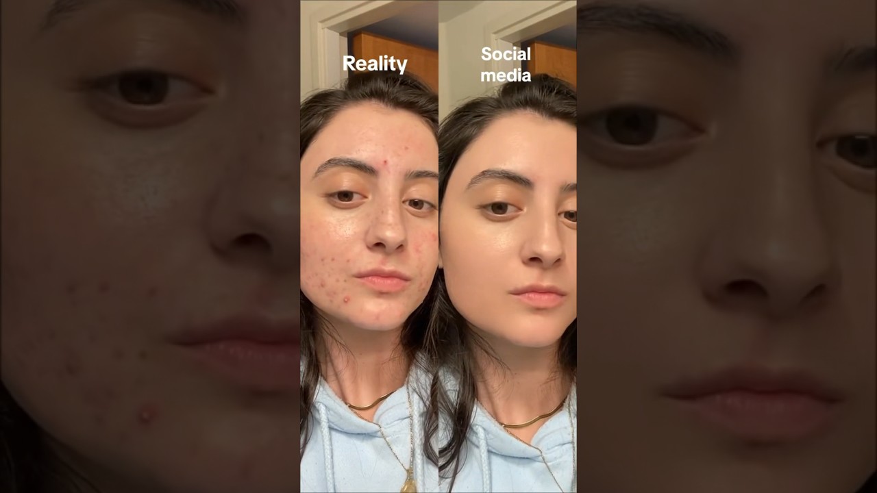Why you shouldn&rsquo;t compare yourself to people online&hellip; #viralbeauty #skinpositivity  #socialmedia