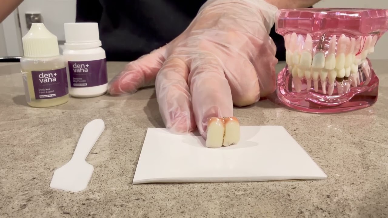 How to Fix a Chipped Tooth with Dental Cement | Step-by-Step Tutorial (DenVana)