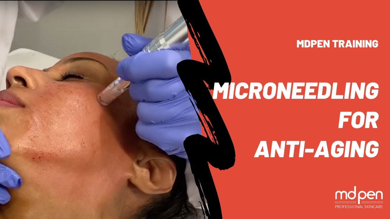MicroNeedling for Anti-aging