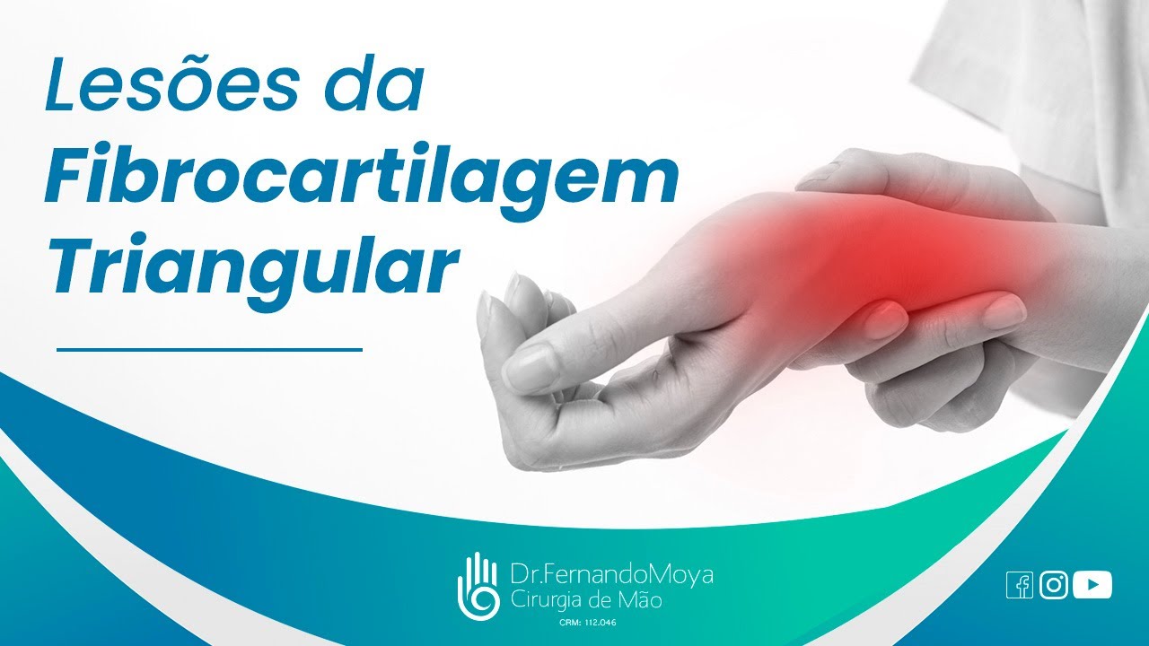 Lesões da Fibrocartilagem Triangular | Dr. Fernando Moya CRM 112046