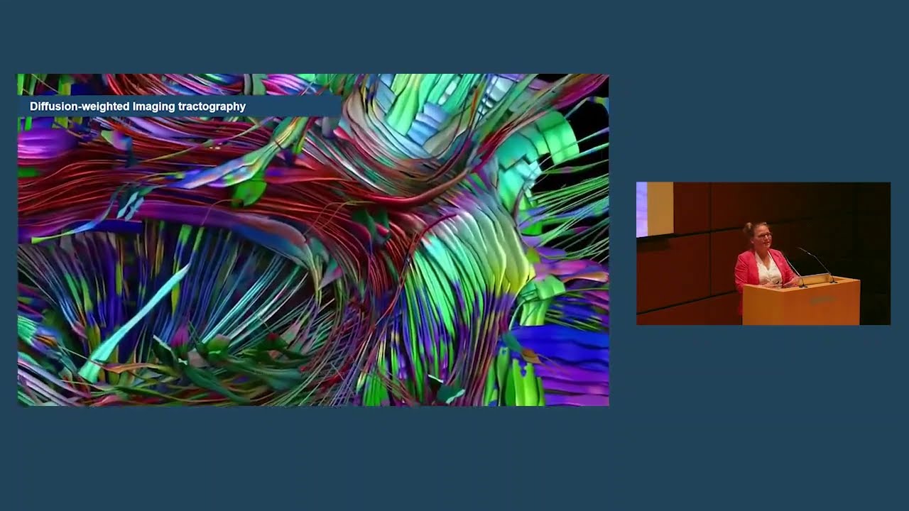Stephanie Forkel on Neurobiology of language: insights from neuroimaging