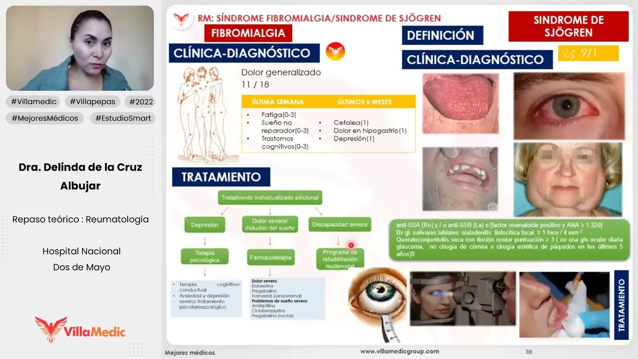 FIBROMIALGIA - SÍNDROME DE SJÖGREN - REUMATOLOGÍA - VILLAMEDIC