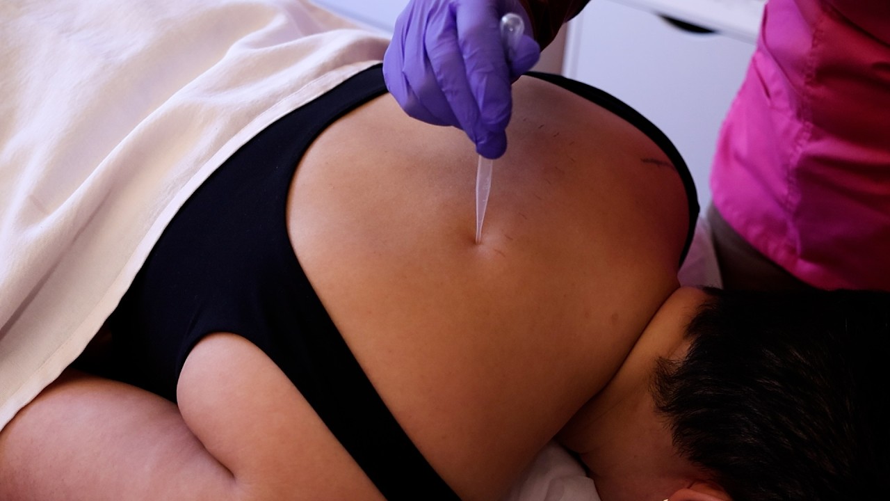 ASMR | Allergy Test and Skin Treatment Exam for Sleep