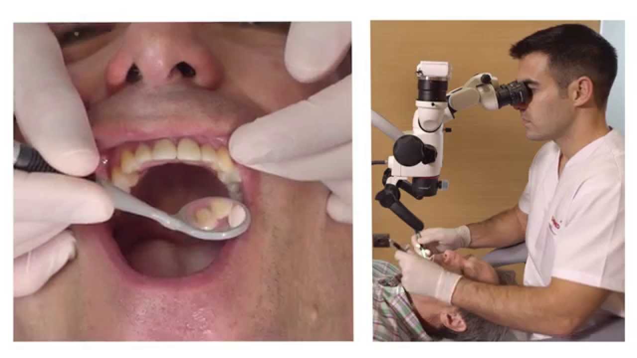 How to position a Labomed Prima DNT Dental Microscope (English)