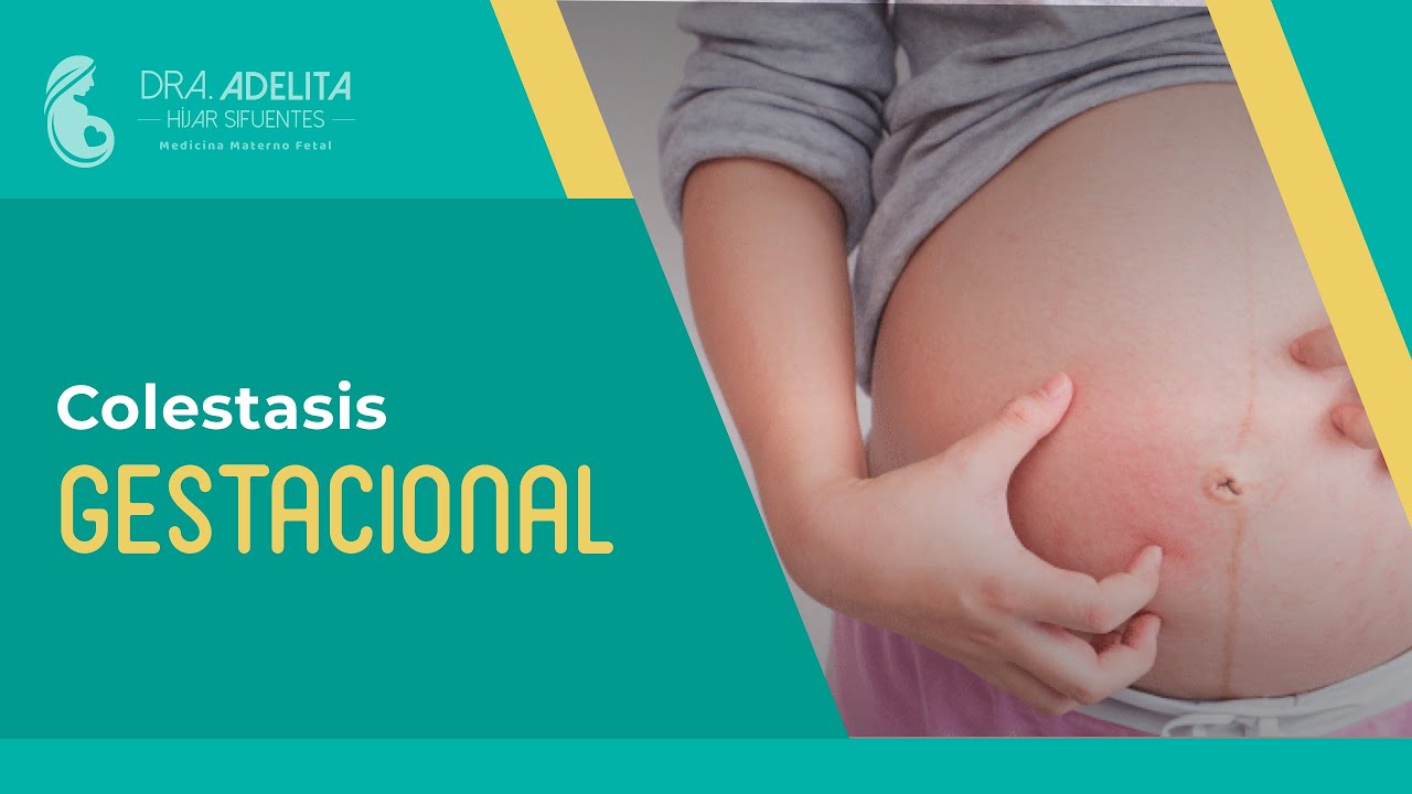 Colestasis gestacional