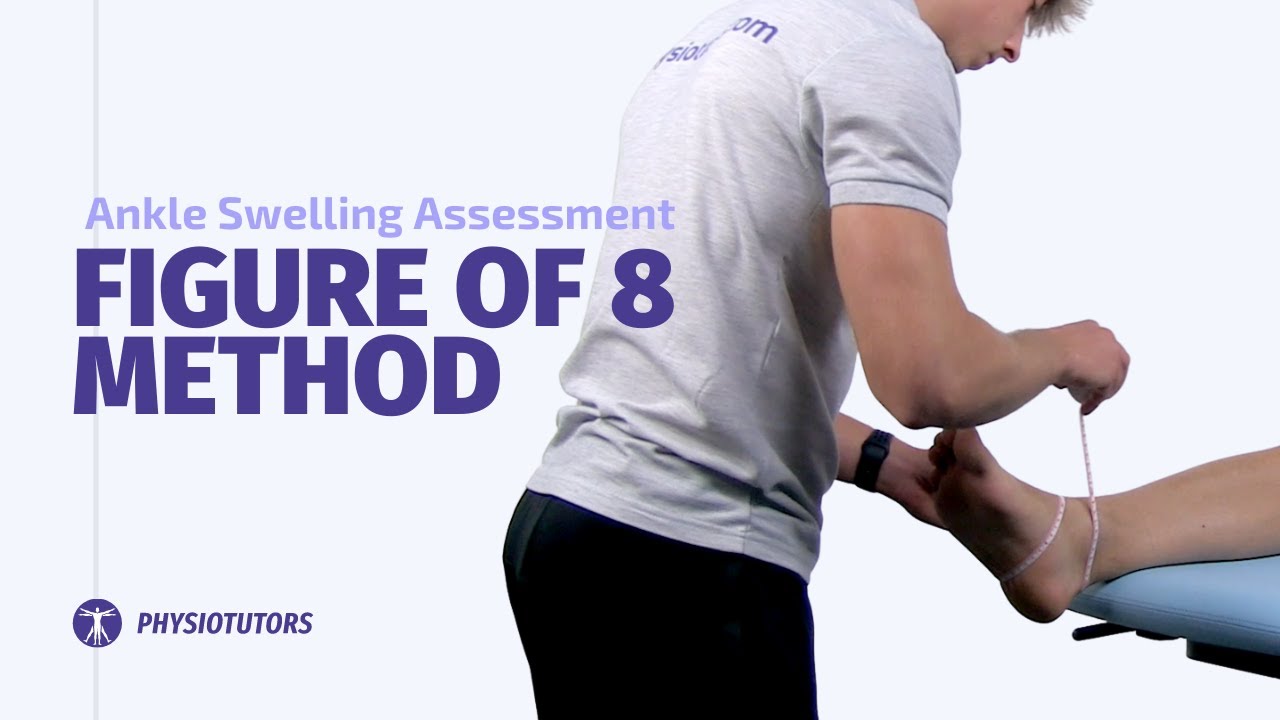 Figure of 8 Method | Measuring Ankle Swelling/Edema