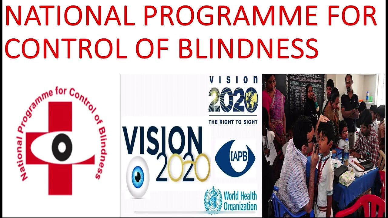 NATIONAL PROGRAMME FOR CONTROL OF BLINDNESS- 2 [Park]