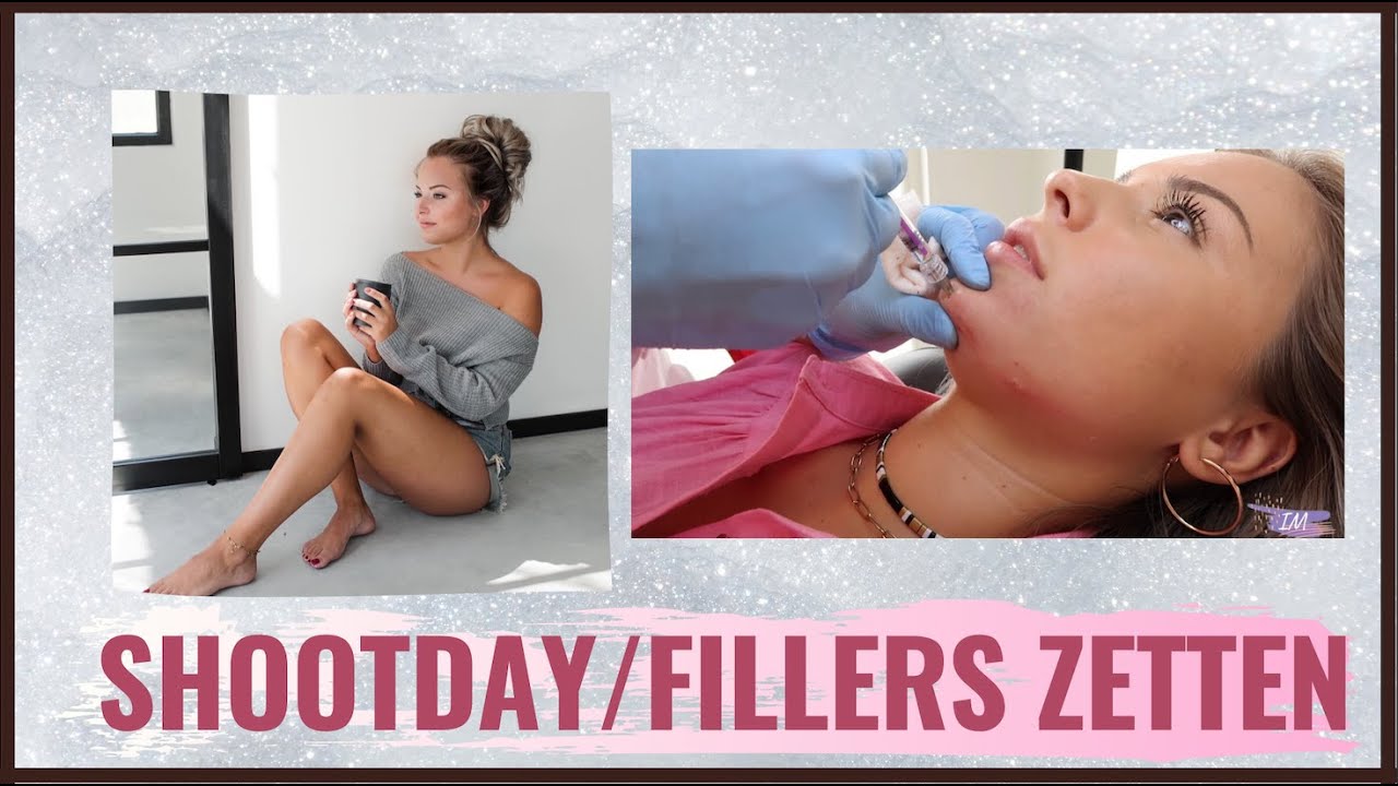 SHOOTDAY/ FILLERS ZETTEN!