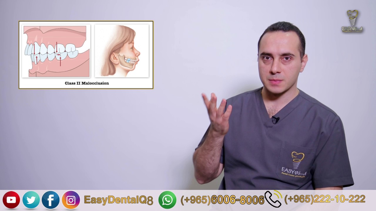 هل يعالج التقويم بروز الفك العلوي ؟