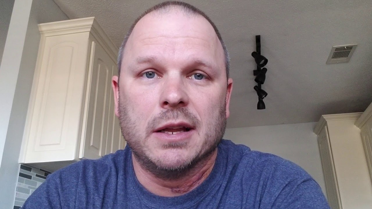 1 week post-op ACDF