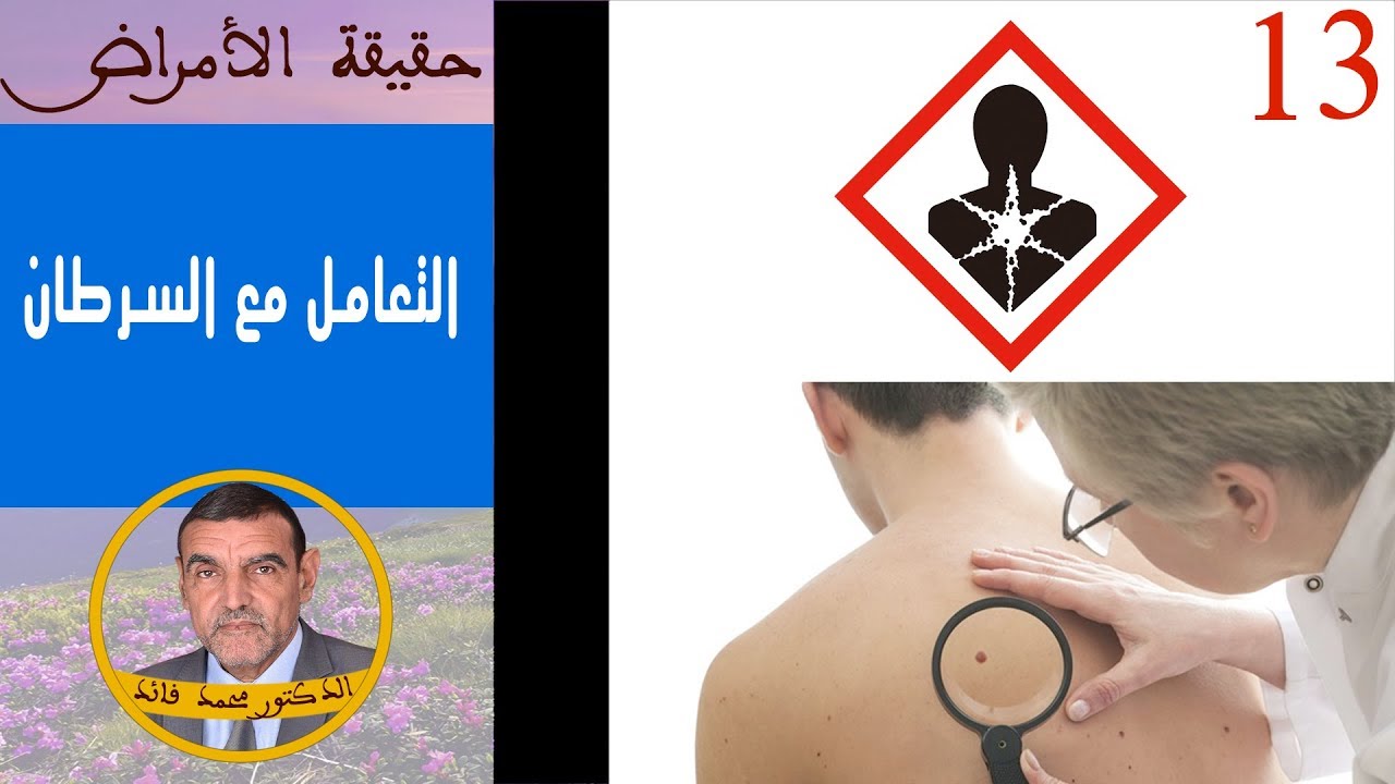التعامل مع السرطان | الدكتور محمد فائد