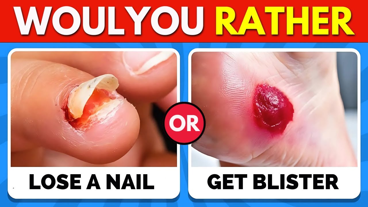Would You Rather...? The Hardest Choices! 😨✅ EXTREME Edition!