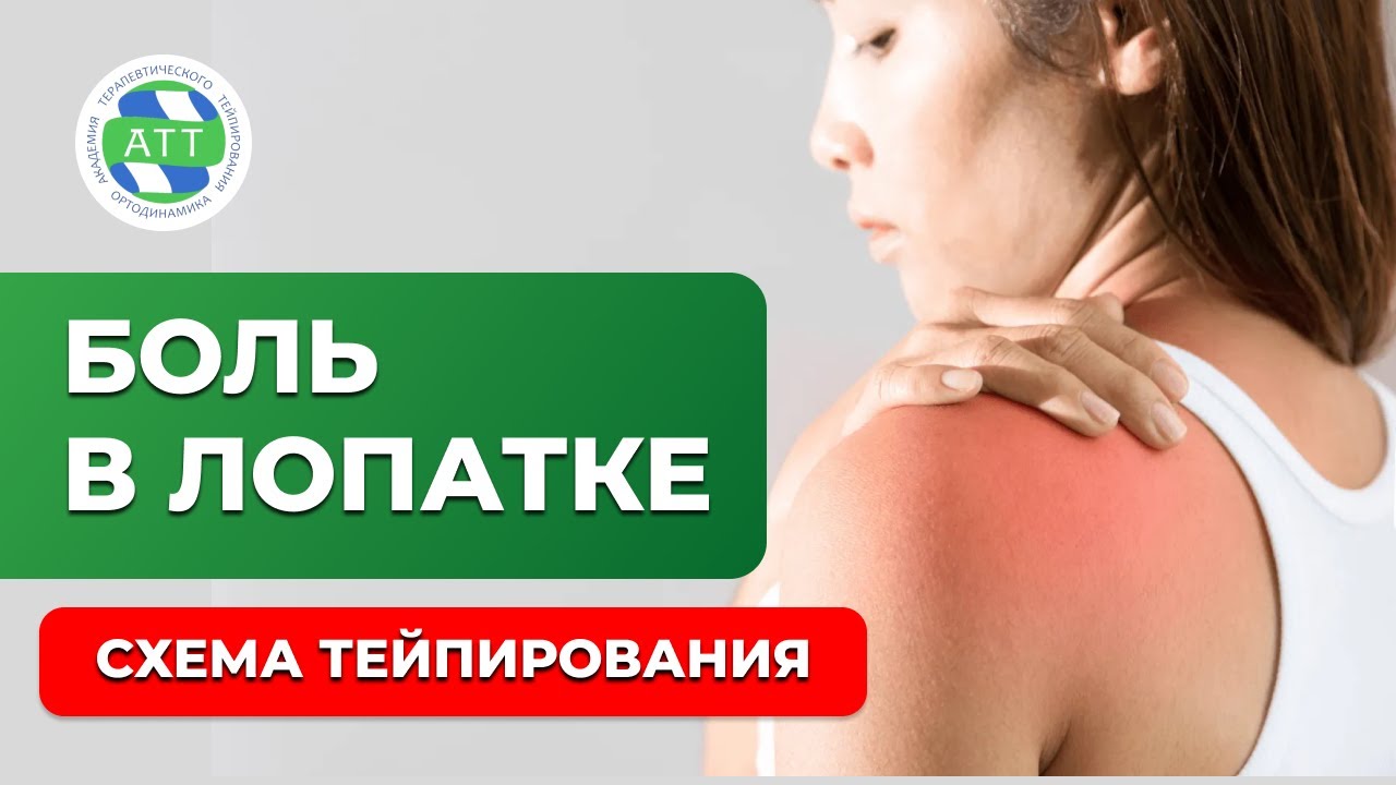✅ Боль в области лопаток. Тейпирование плеча. Триада тейпирования