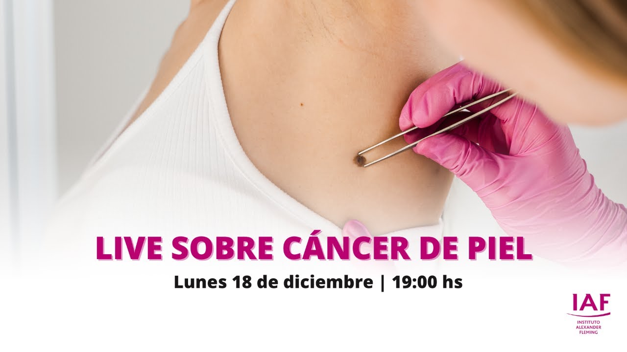 IAF LIVE | Cáncer de Piel