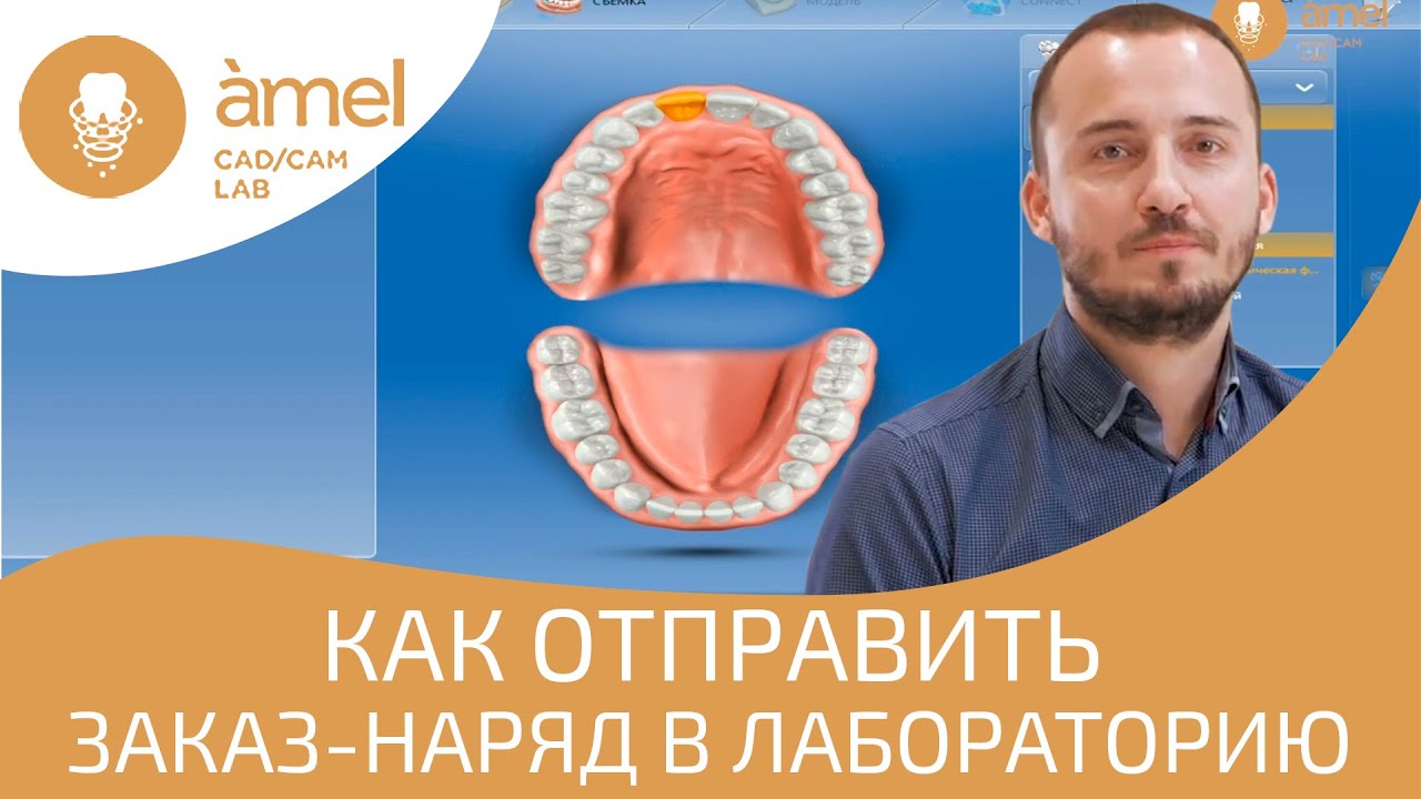 Как правильно отправить заказ-наряд в лабораторию | Bauers Cad/Cam Lab