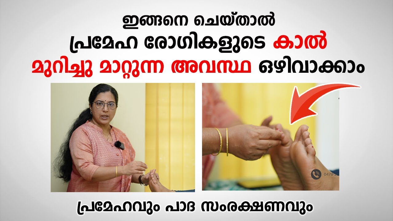 ഈ കാര്യം ചെയ്താൽ പ്രമേഹ രോഗികളുടെ കാലുകൾ മുറിച്ചു മാറ്റുന്ന അവസ്ഥ ഒഴിവാക്കാം | Diabetic foot