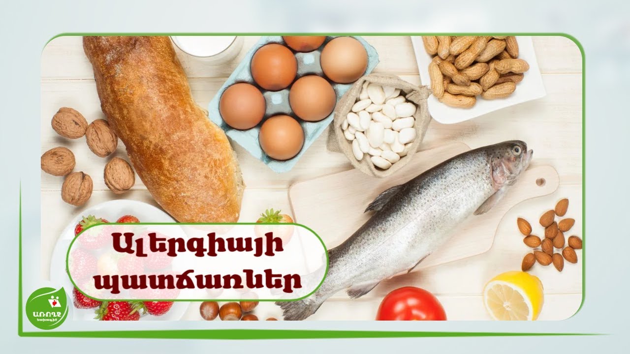 Ճշտեք, թե ինչից ունեք #ալերգիա  - #Առողջնախագիծ