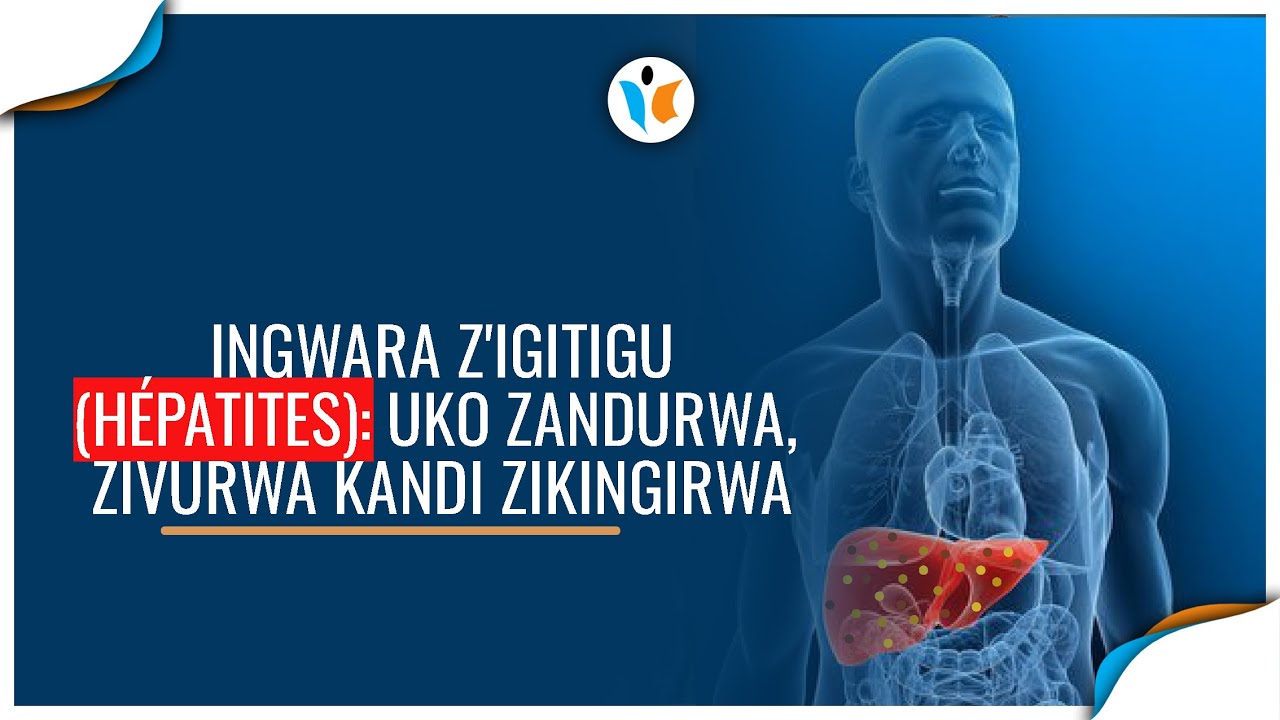 🤔 Ingwara y'igitigu 