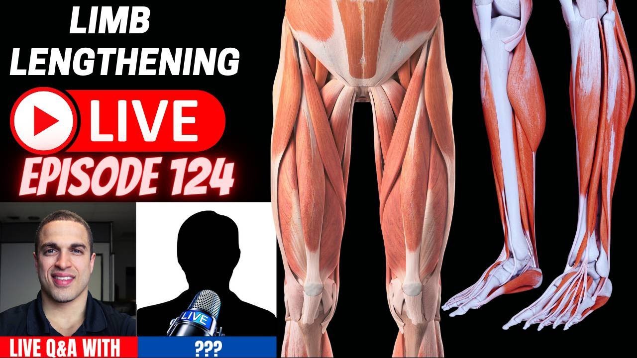 Limb Lengthening LIVE Ep 124 w/ Socrates, Ryan, Ayvinator, ZZZ