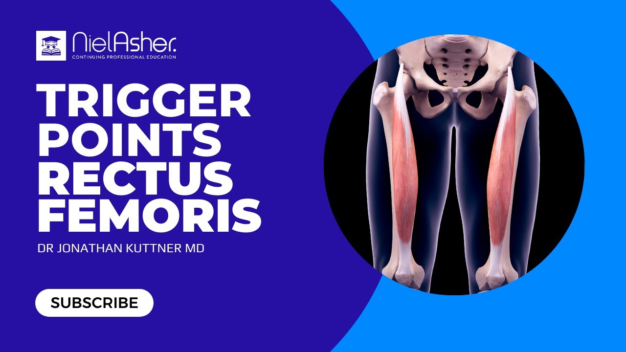 Rectus Femoris - Trigger Point Anatomy