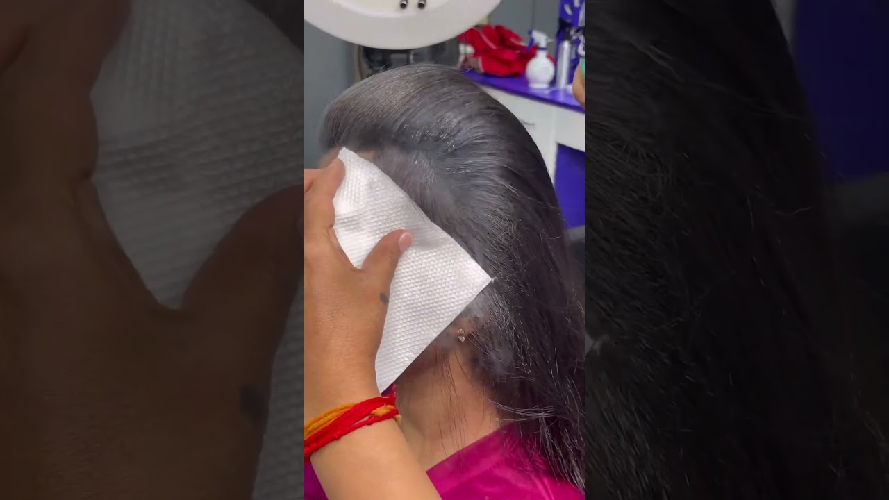 How to cover baldness|