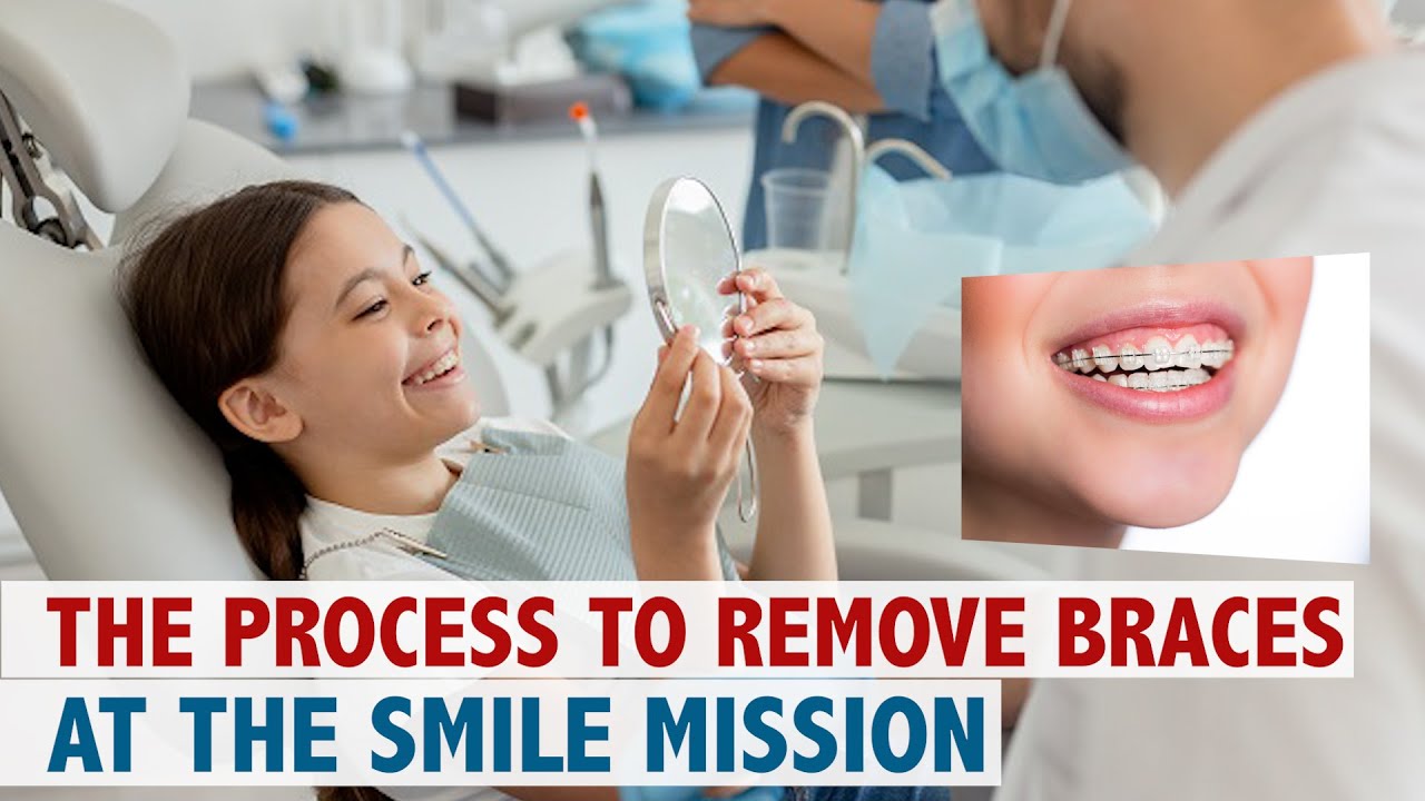 The Process to Remove Braces at The Smile Mission