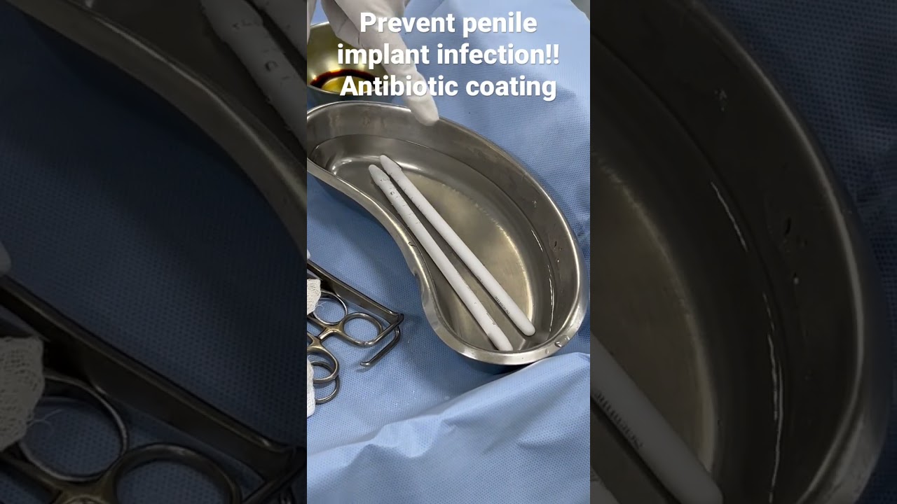 Penile implant infection | prevent by antibiotic coating !!