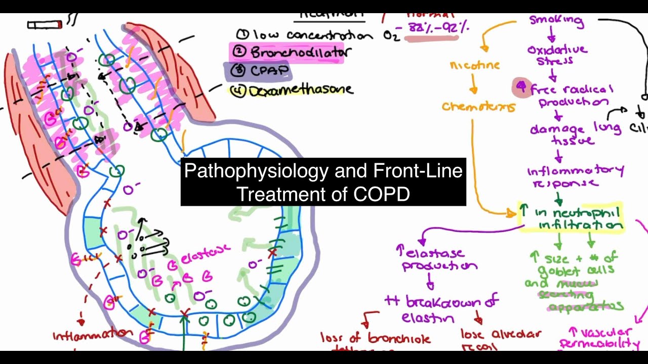 Pathophysiology and Treatment of COPD