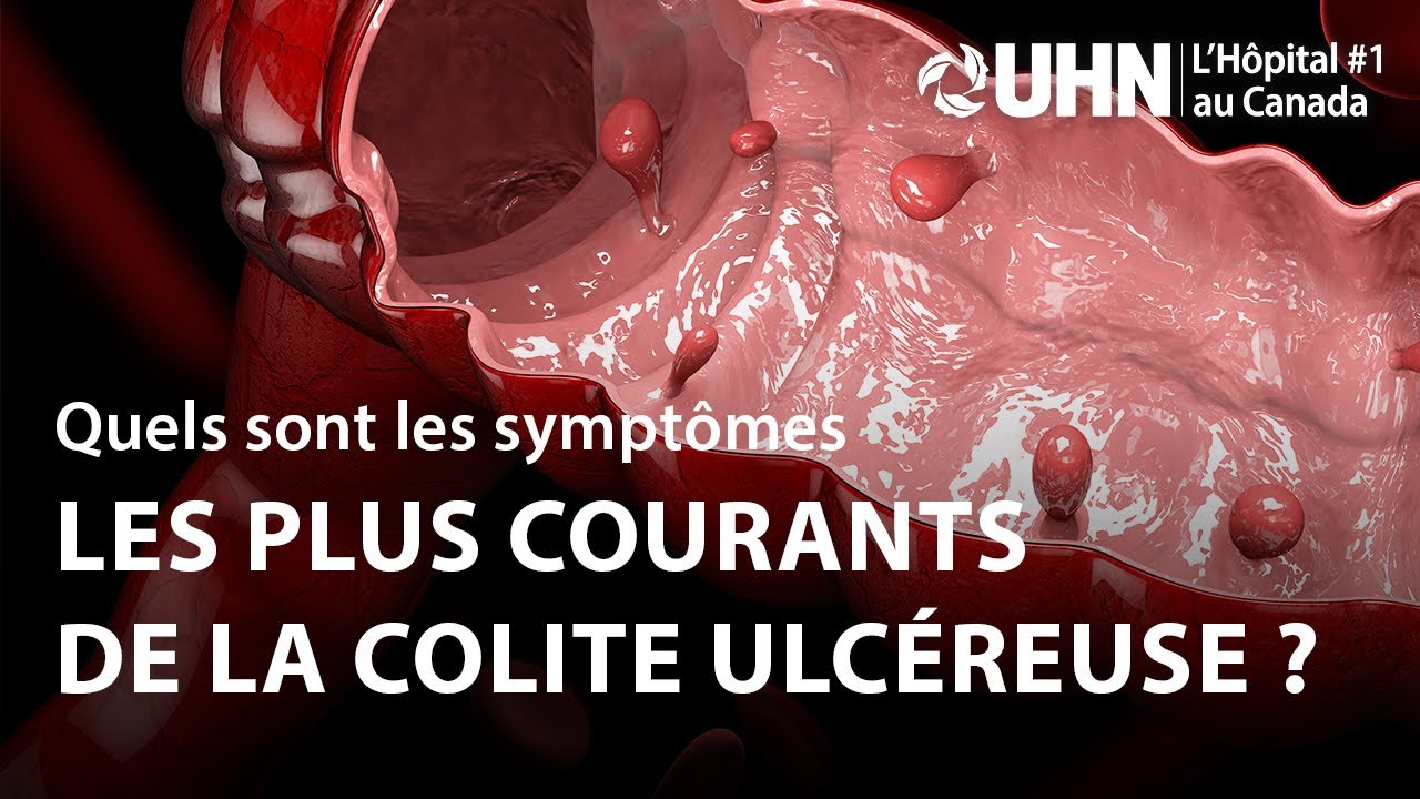 L'UHN Explique : La colite ulcéreuse | UHN Explains: Ulcerative Colitis