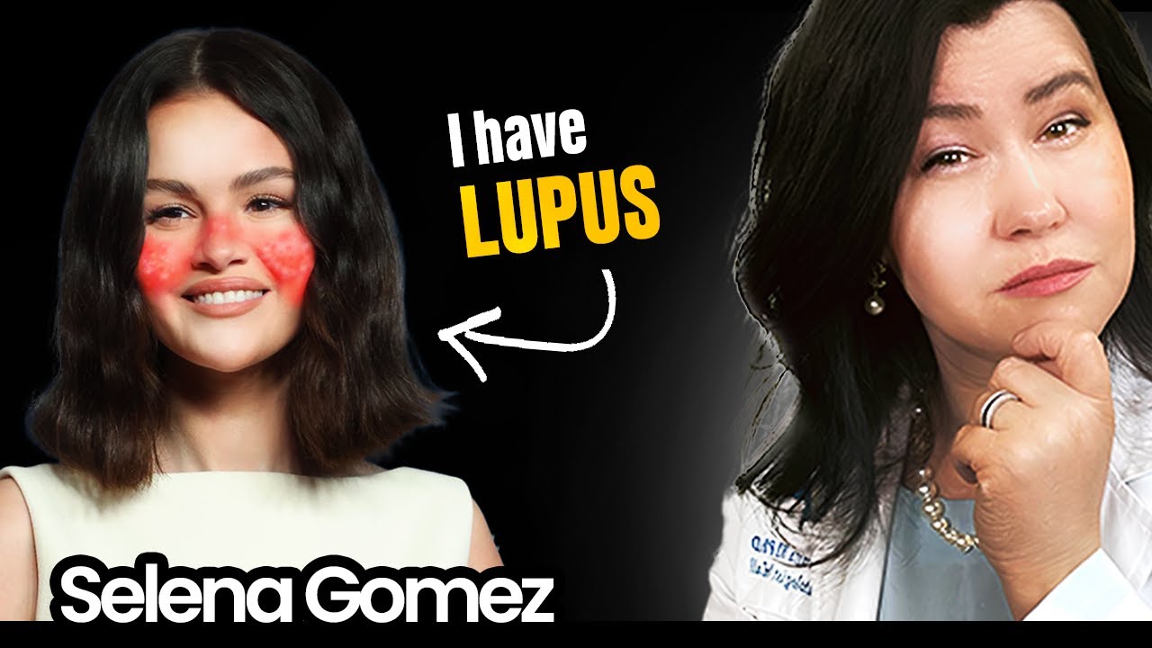 Selena Gomez Fights For Her Life Against Lupus Disease