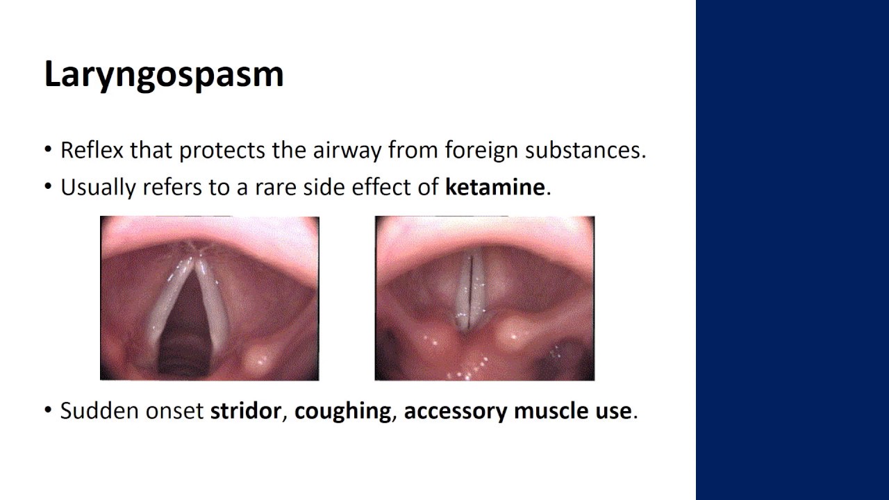 Complications of Procedural Sedation
