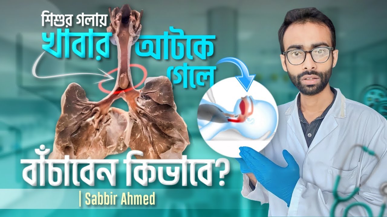 শিশুর গলায় খাবার আটকে গেলে কি করবেন?||Sabbir Ahmed