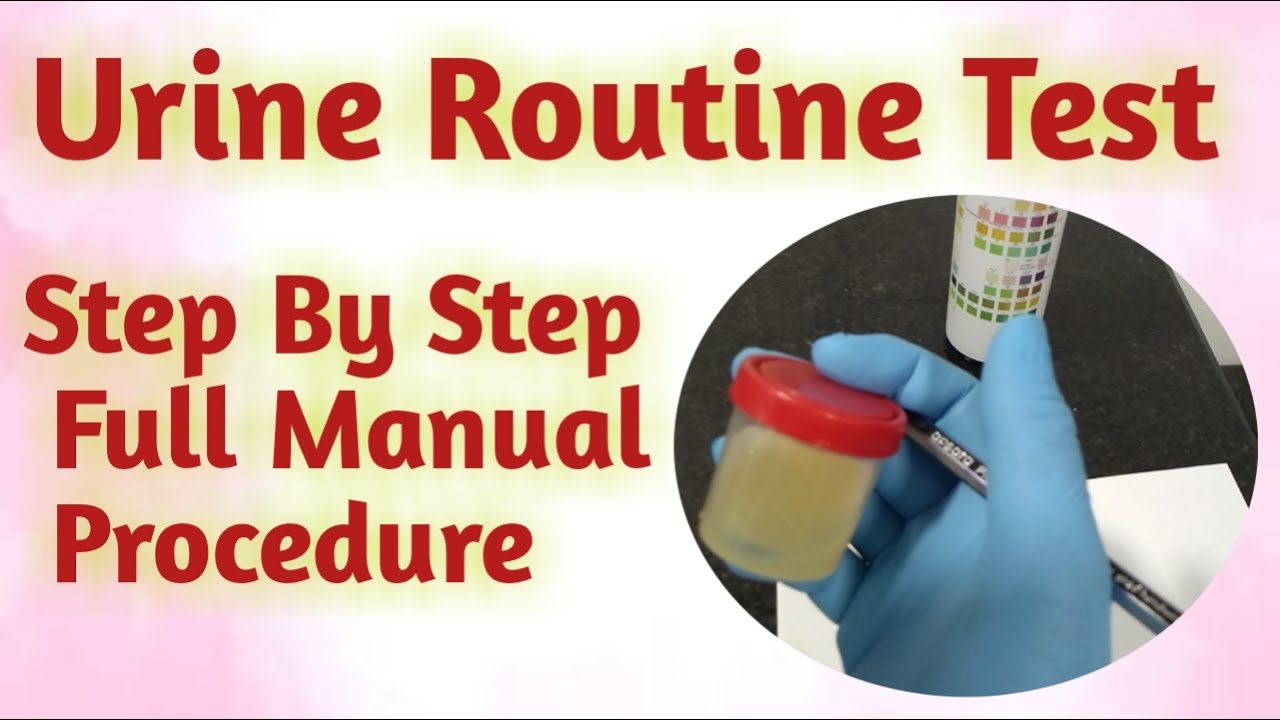 urine routine test | How to Process urine routine