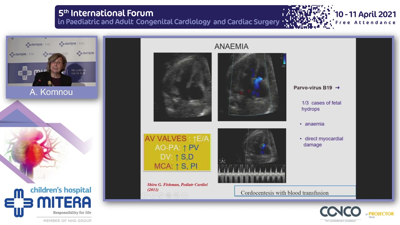 Heart failure in the fetus - diagnostic assessment and management