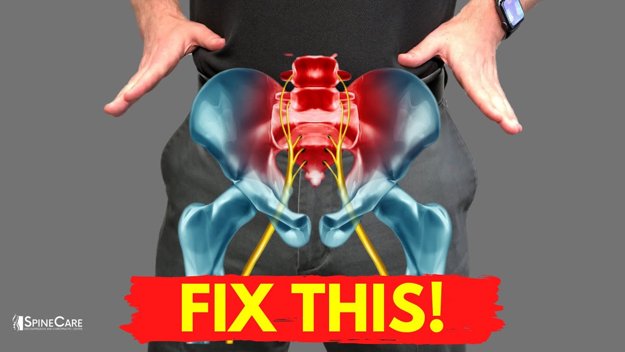 How to Get Rid of Sciatica Pain AT HOME